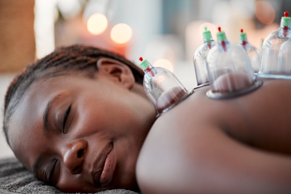 Black Woman, Face and Smile in Cupping Therapy on Back for Pain Relief, Relaxation or Blood Flow at Resort. Happy African American Female Smiling in Relax for Glass Vacuum Cups in Deep Tissue Massage